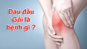 đau đàu gối là bệnh gì